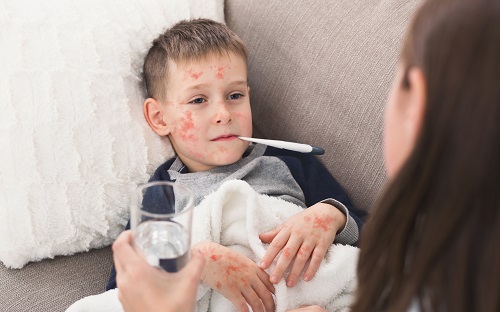 Measles in unvaccinated children in Ohio