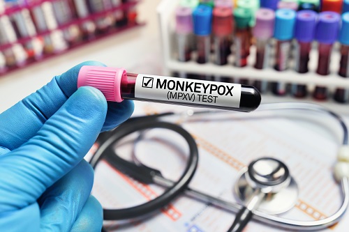 Five Tactics for Mitigating the Risks of Monkeypox and Other Viruses in Sports