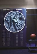 MRSA: What You Do (and Don’t) Have to Worry About